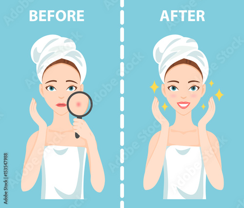 Before-After set of upset troubled and happy woman with female facial skin problems needs to care about: acne, pimples.