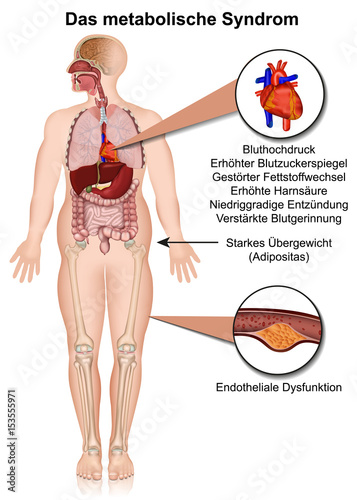 Das metabolische Syndrom