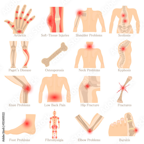 Orthopedic diseases icons set, cartoon style