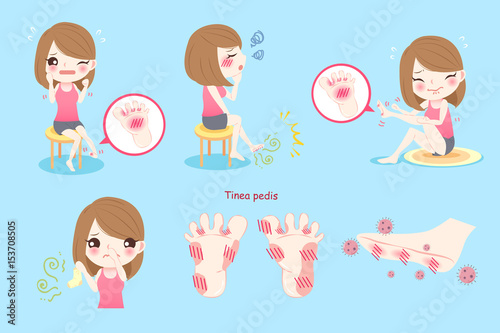 woman with tinea pedis