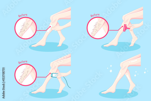 leg hair removal concept