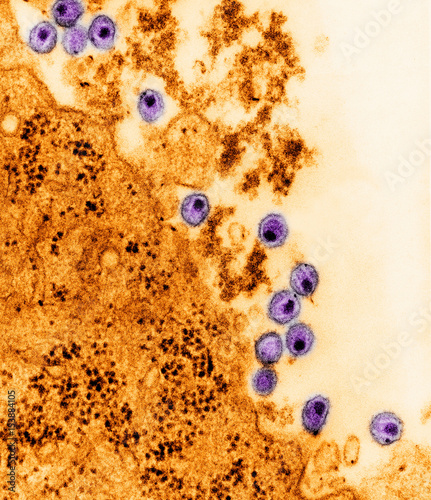 Electron micrograph of HIV virus photo