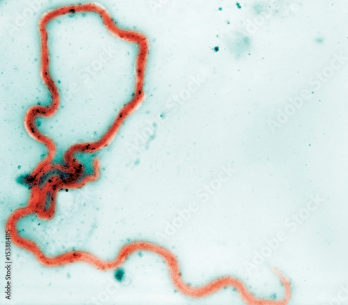 Photomicrograph of Treponema pallidum bacteria photo