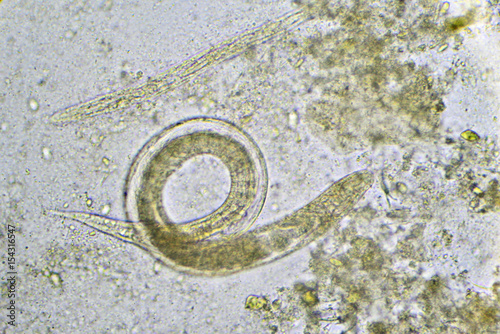 Strongyloides stercoralis (threadworm) in stool, analyze by microscope
 photo