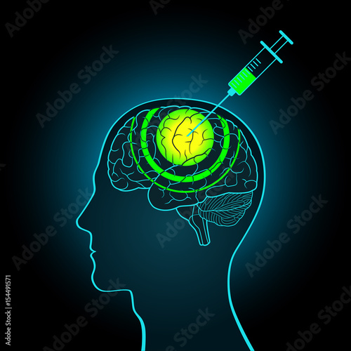 The injection syringe into the brain of truth serum, brainwashing, making new data
