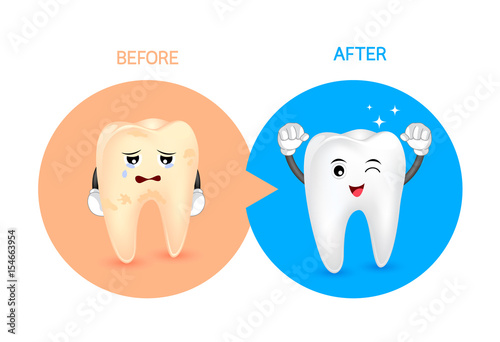 Cartoon tooth character before and after. Whiten yellow teeth. Dental care concept,  illustration.