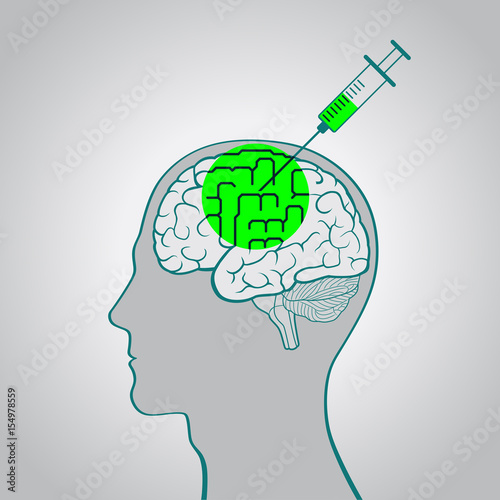 A syringe injection into the brain of a truth serum straightening out curves, brainwashing, flashing