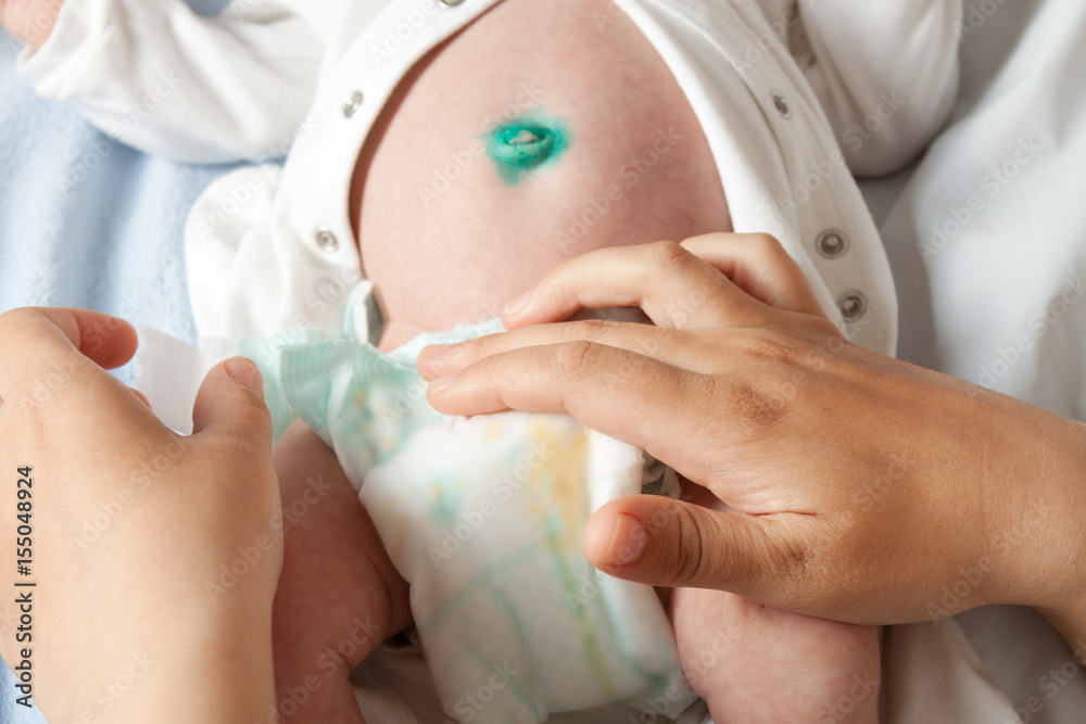Obraz premium Mom changes the baby's diaper.