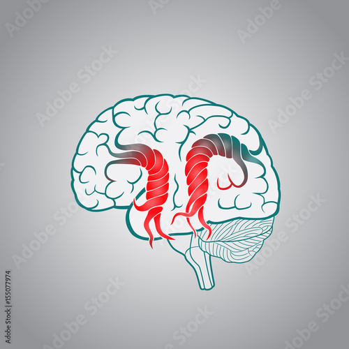 Brain with the twisted convolutions, of the destruction of the brain, stroke, memory, disruption of the normal activities of the brain