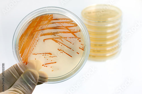 Colonies of bacteria Streptococcus agalactiae in culture medium plate / holding plate with bacterial colonies of Streptococcus agalactiae