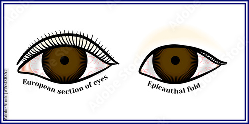 Epicanthal fold. Fold at the inner corner of the eye.