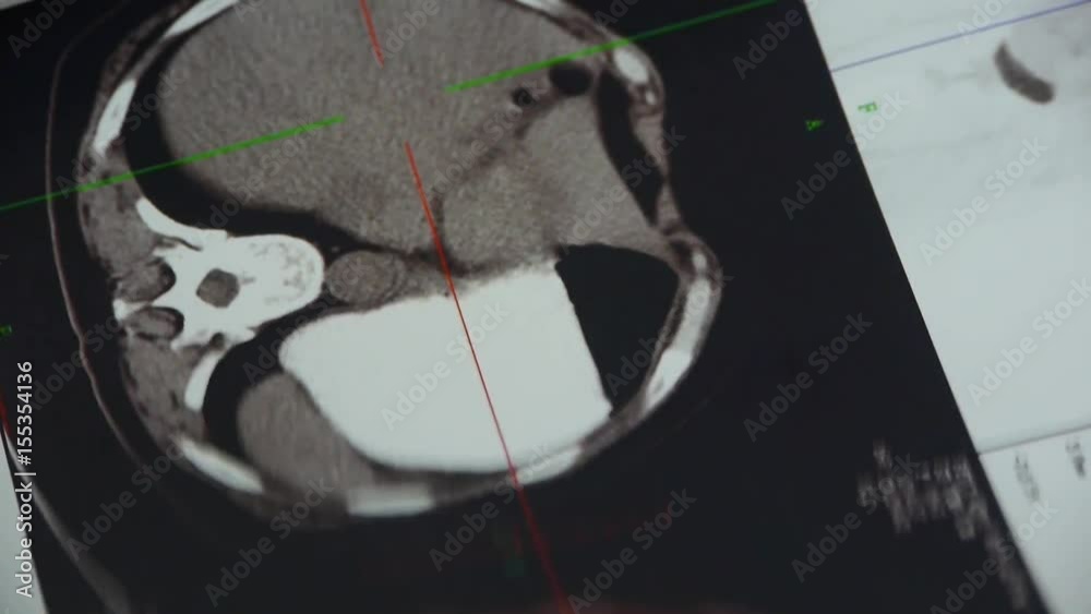 doctor study color head & vertebral pet-ct,skull brain X-ray. Stock ...
