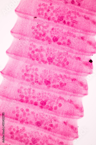 Wallpaper Mural Raillietina echinobothrida is a parasitic tapeworm belonging to the class Cestoda. Torontodigital.ca