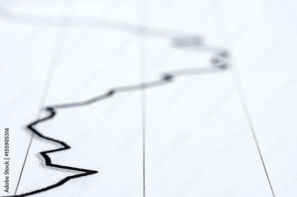 Naklejka premium Statistical charts