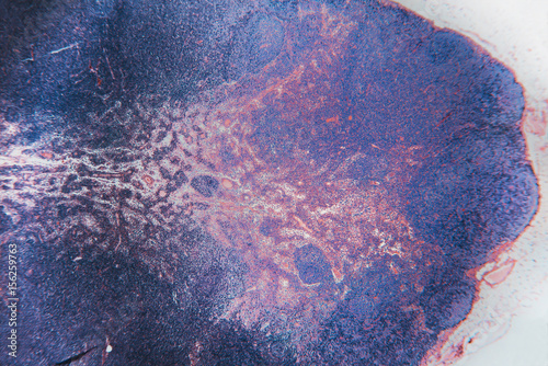 Macro cell- lymph node dog