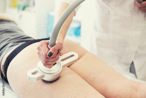 rf lifting procedure