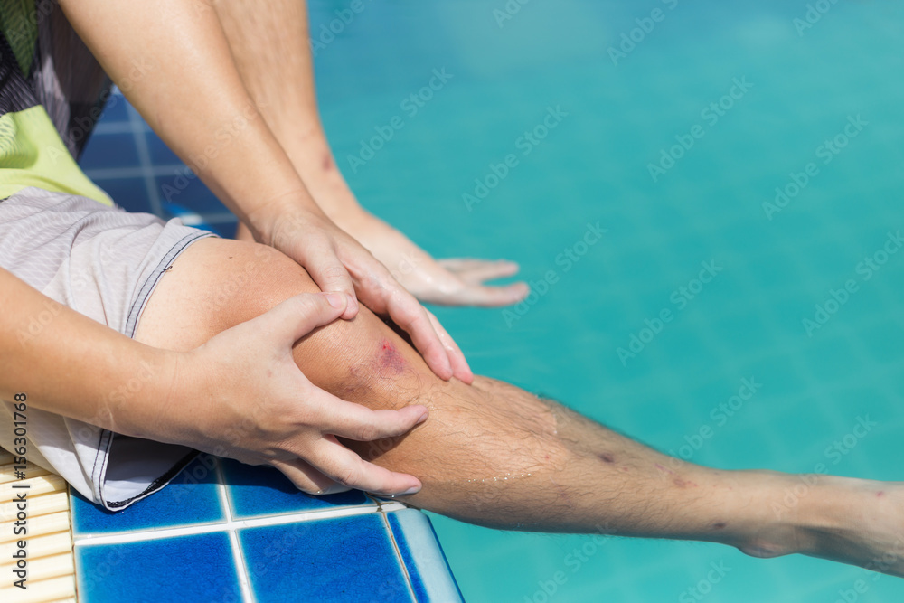Wound on man knee after got slip accident in pool Wound on man knee after got slip accident in pool