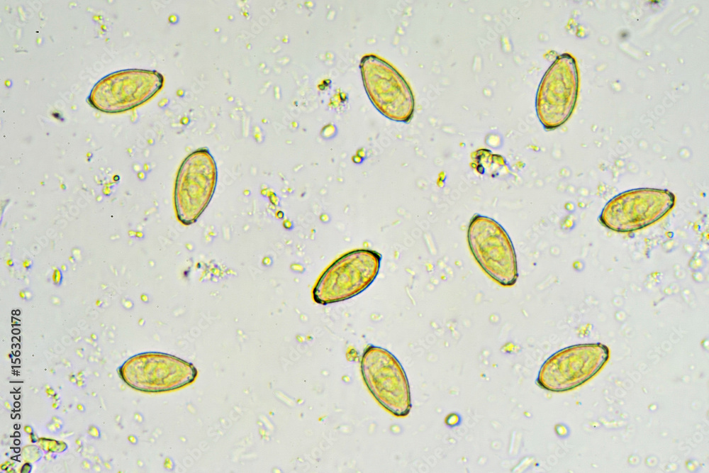 Eggs of Opisthorchis viverrini (Southeast Asian liver fluke) in stool,  analyze by microscope Stock Photo