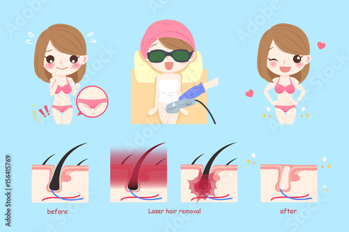 laser bikini line hair concept