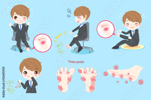 businessman with tinea pedis