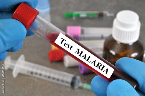 Test sanguin de la malaria photo