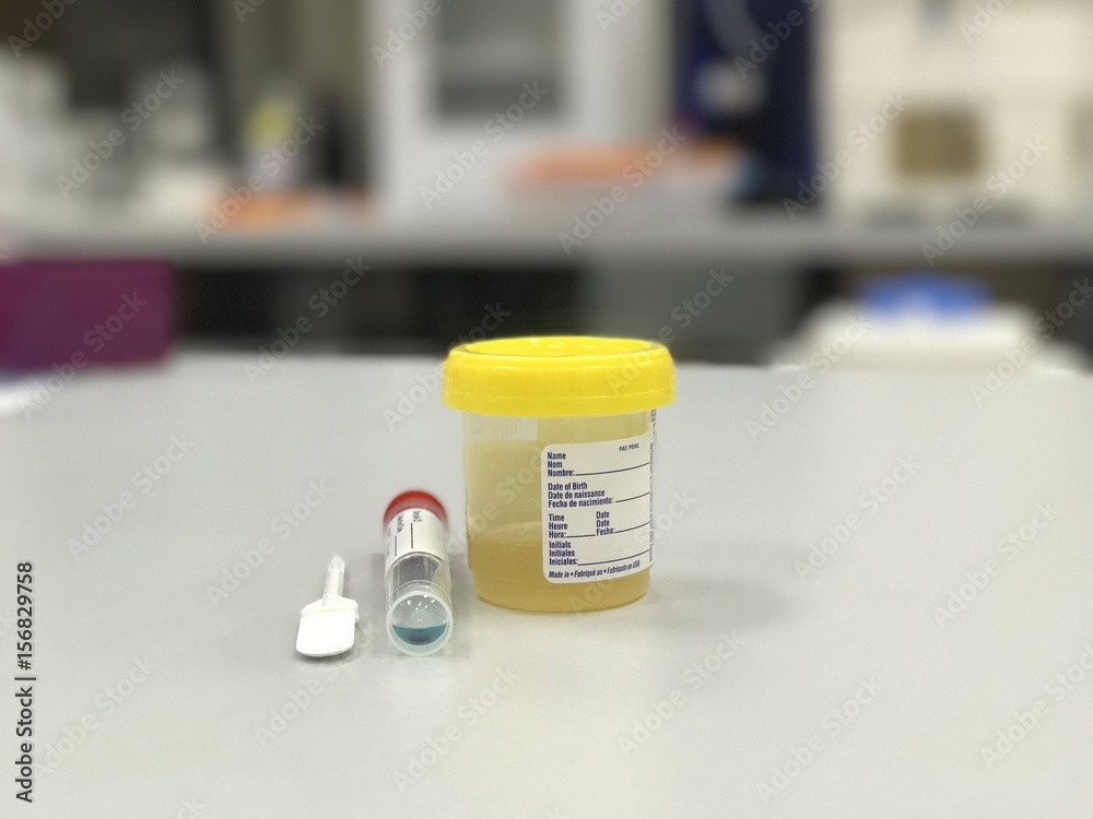 Toxicology Sample Collection