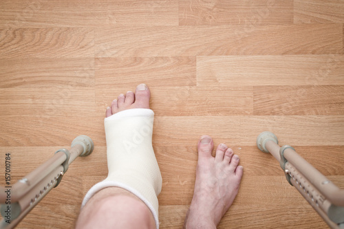 Leg in plaster and crutches on a wooden background