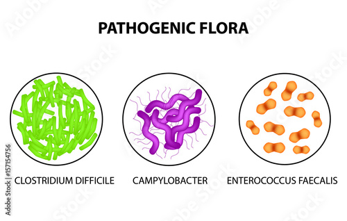 Pathogenic flora. Clostridium difficile, Campylobacter, Enterococcus faecalis. Infographics. Vector illustration on isolated background.