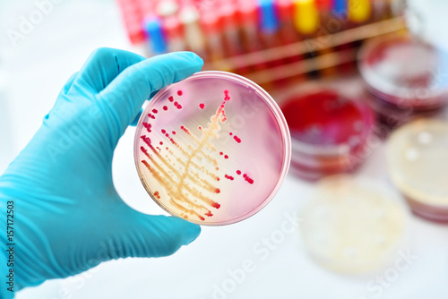 Colonies of bacteria in MacConkey agar 