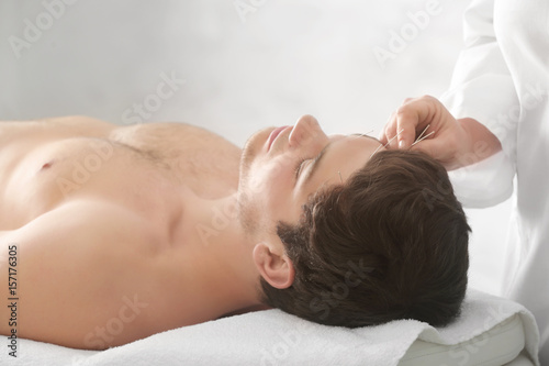 Young man undergoing acupuncture treatment in salon