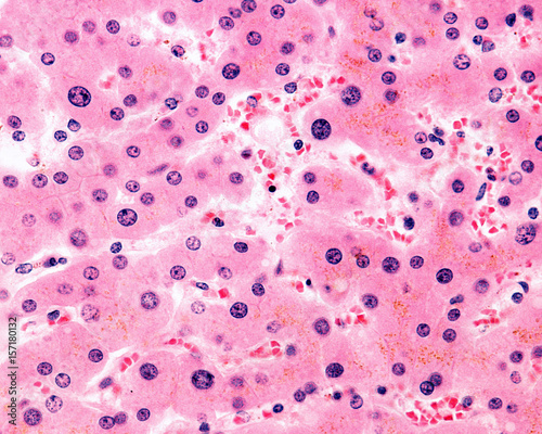 Polyploid nuclei photo