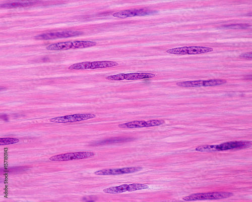 Smooth muscle cells. Nuclei photo