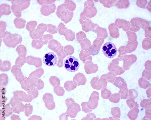 Neutrophils. Blood smear photo