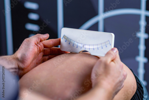 Εκτύπωση καμβά Pedi-Scoliometer for Scoliosis Screening