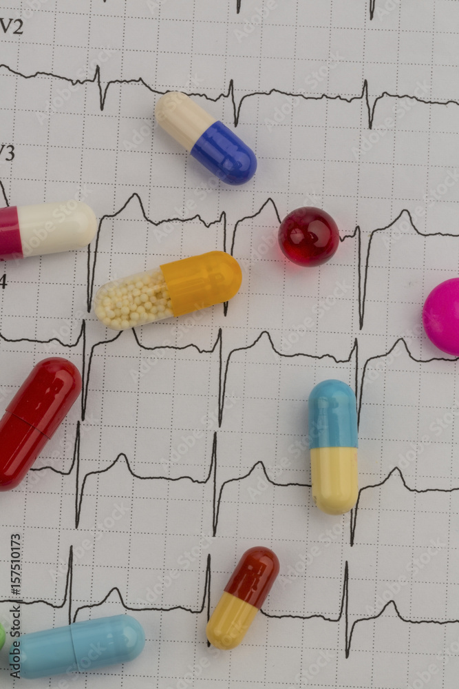 tablets on an ekg tablets on an ekg