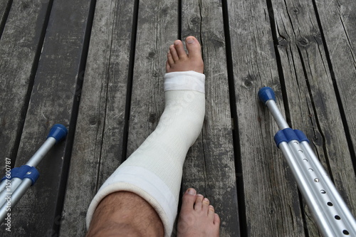 骨折した足
