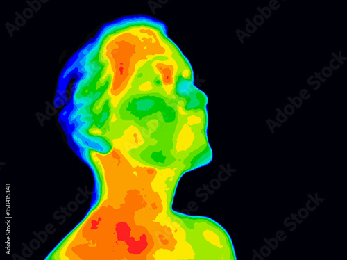 Thermographic image of human face and neck showing different temperatures in range of colors from blue cold to red hot. Red in neck might indicate raised CR-P levels and Carotid Artery inflammation. photo
