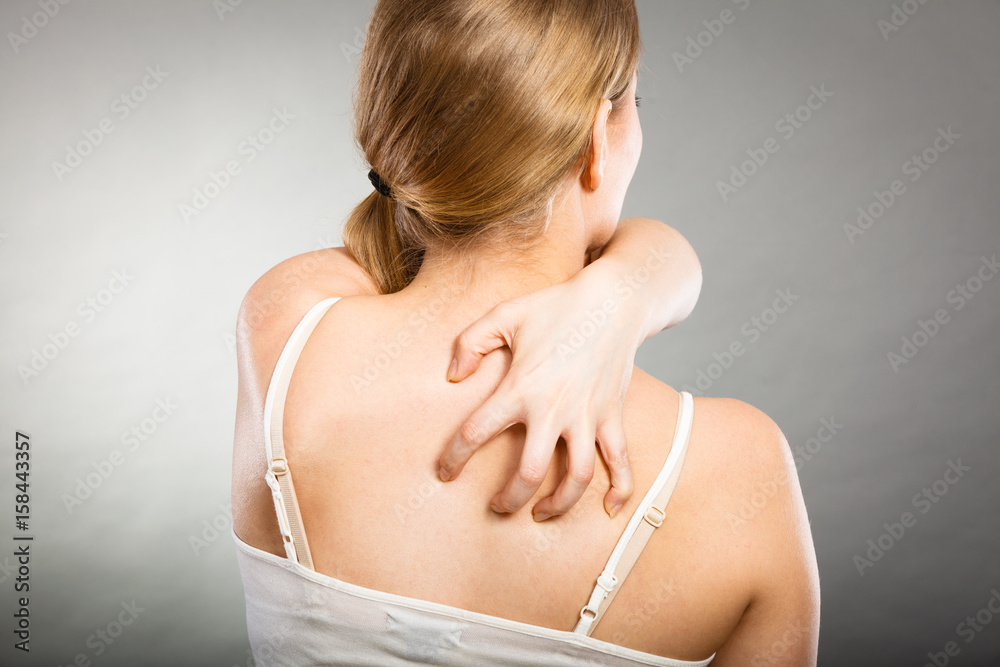 woman scratching her itchy back with allergy rash woman scratching her itchy back with allergy rash