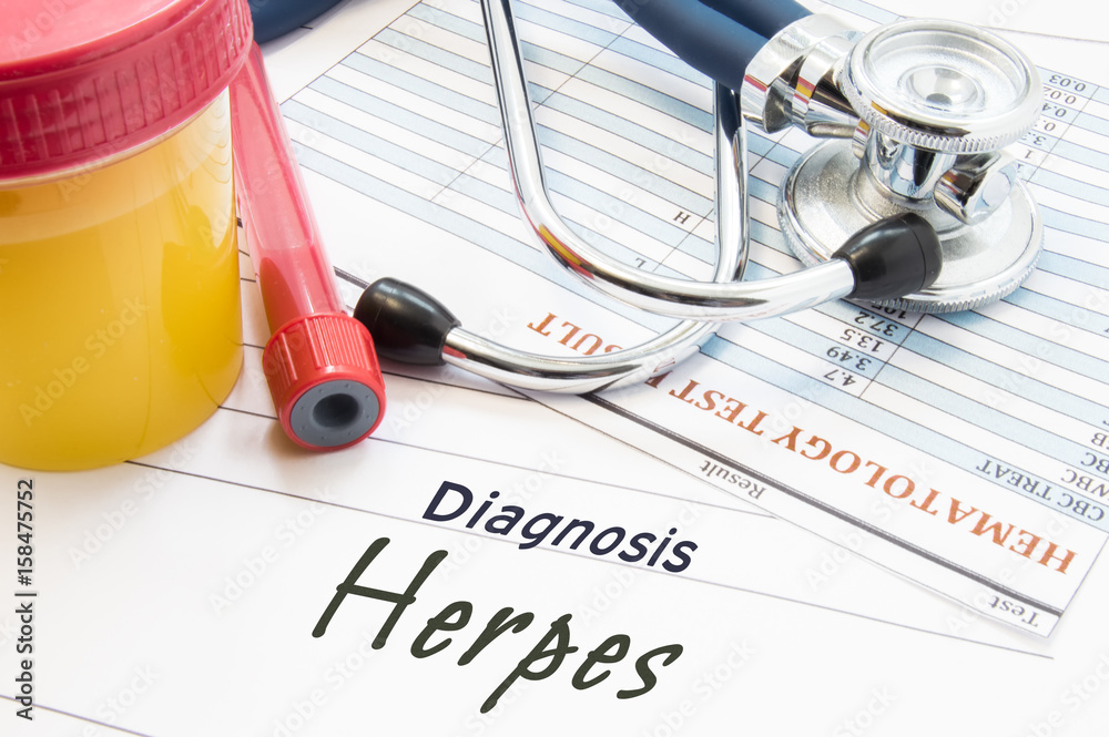 Diagnosis Herpes. Stethoscope, lab test tube with blood, container with