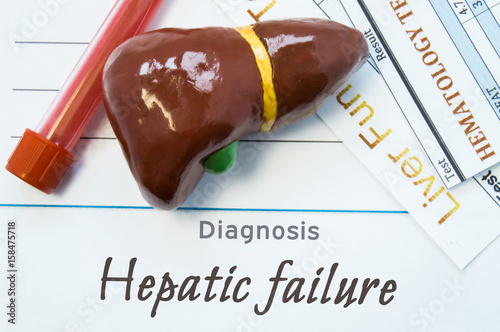 Hepatic failure diagnosis. Sheet of paper or book with inscription Hepatic failure lie next to stethoscope, model of human liver and two lab tests - common blood test and analysis of liver functions photo