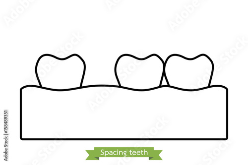 spacing teeth ( diastema ) - cartoon vector outline style