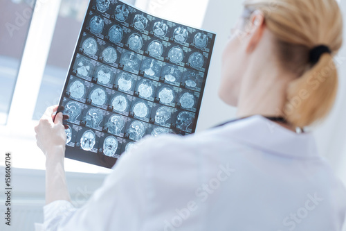 Involved neurosurgeon examining roentgen brain results at the laboratory