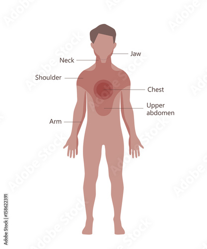 Heart Attack Pain Location