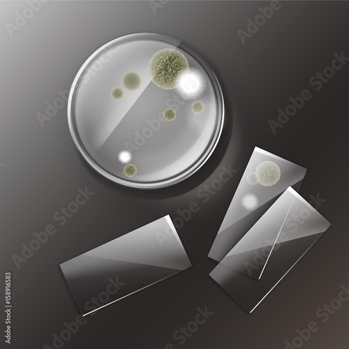 Petri dish with molds