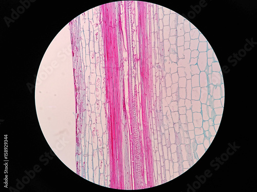 Plant stem, long section under microscope view