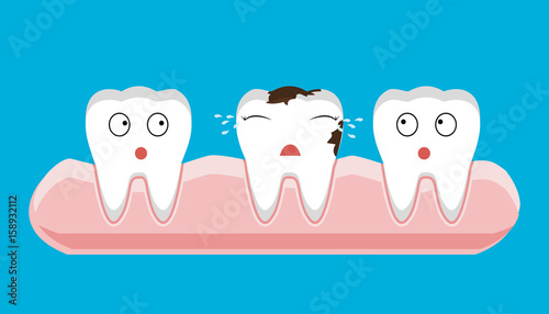 illustration of tooth sectional view decay with caries dental health problem - vector