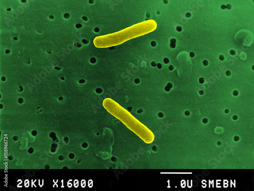 Salmonella typhimurium photo