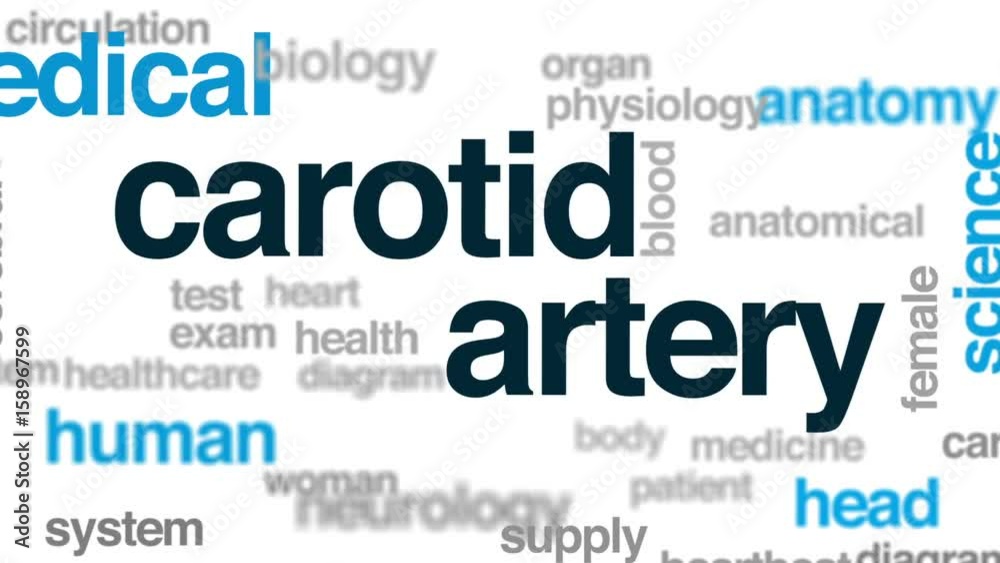 Carotid artery animated word cloud, text design animation. Carotid artery animated word cloud, text design animation.