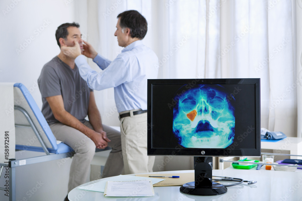 X-ray showing a maxillary sinusitis X-ray showing a maxillary sinusitis