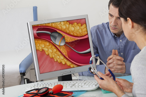 Models On screen, illustration of a rotational atherectomy by rotablator Rotablator pulverizing the calcified plaque of atheroma Here, example of a coronary artery photo